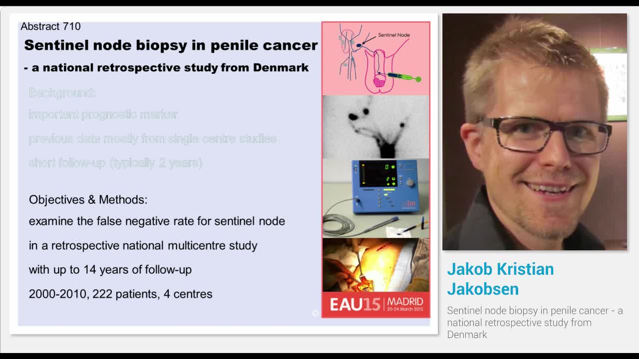 Sentinel node biopsy in penile cancer - a national retros..-
