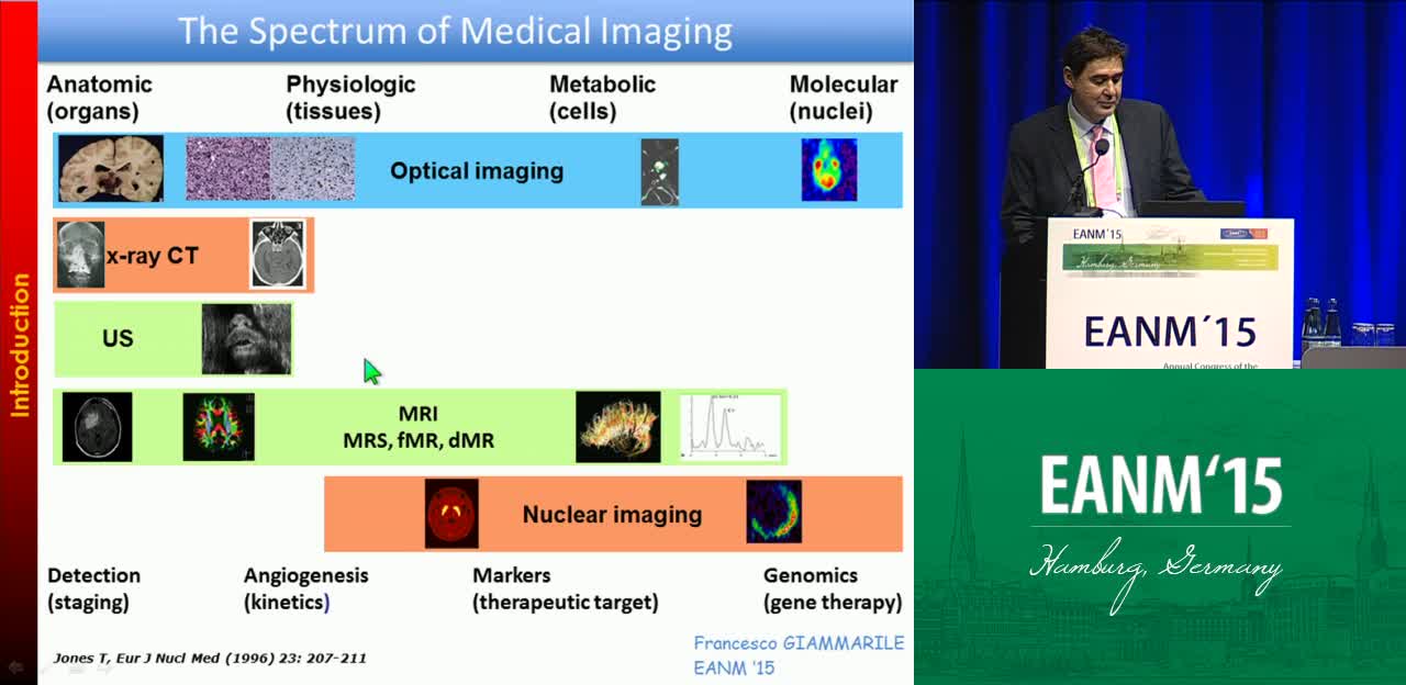 PET-MR在软组织肉瘤中的作用
