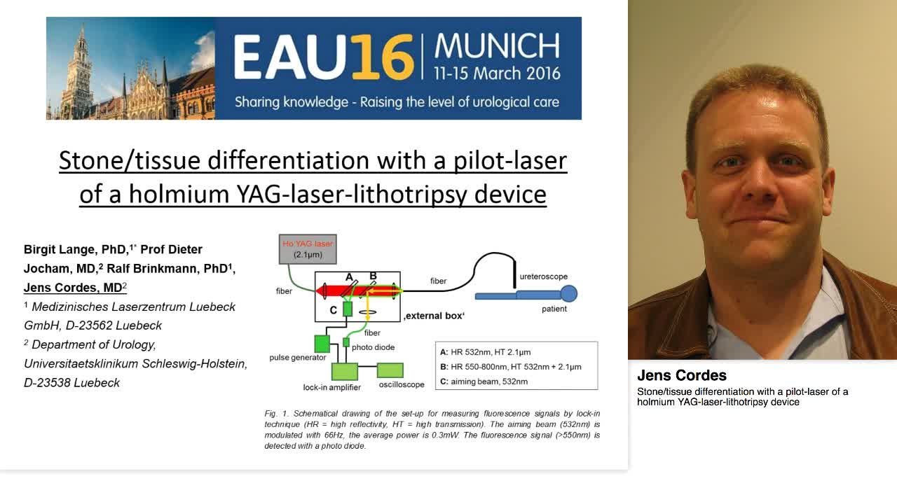 Stone-tissue differentiation with a pilot-laser of a holm-