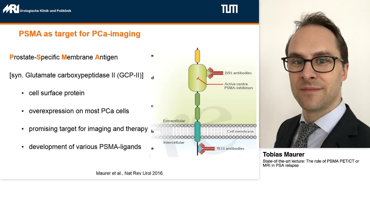 The role of PSMA PET-CT or MRI in PSA relapse