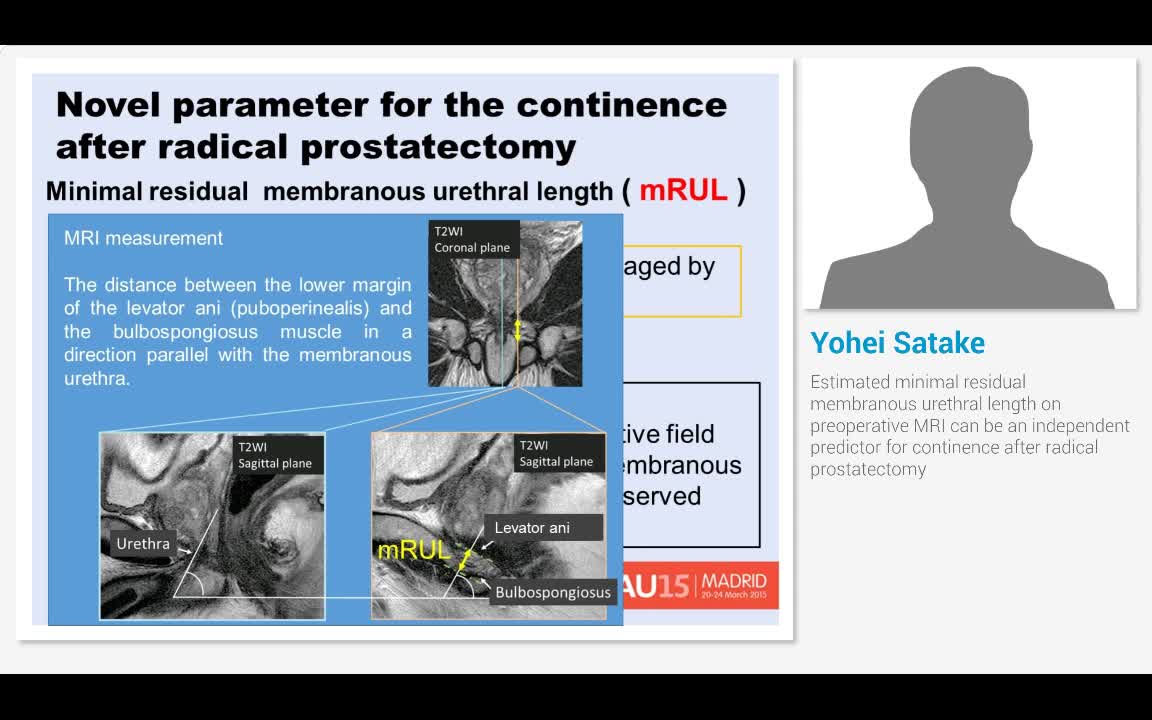 Estimated minimal residual membranous urethral length on ..-