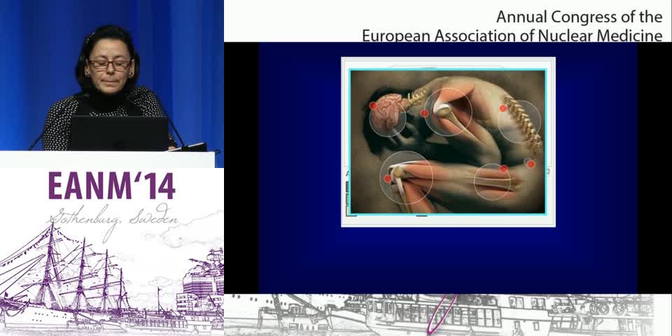 免疫功能低下患者的腰痛