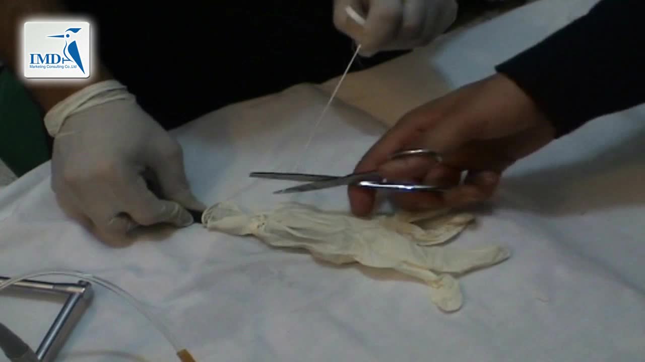 内窥镜处理泌尿系统结石手套模拟法