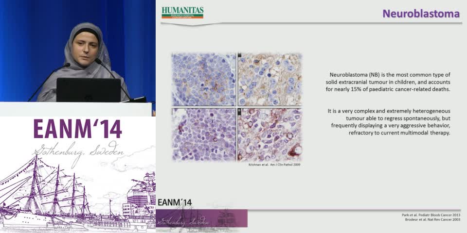 神经母细胞瘤的反应评估&mdash;&mdash;以F-DOPA为重点