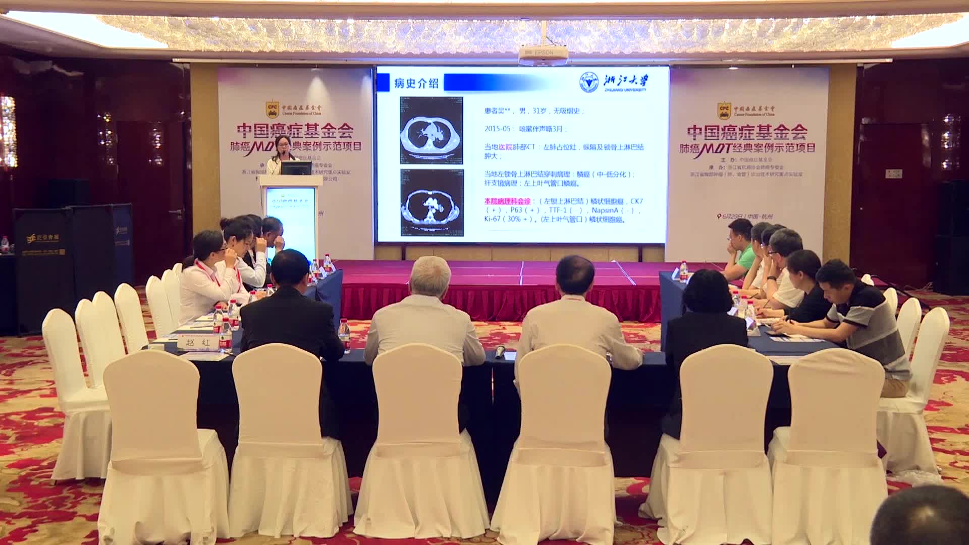 18.一例ALK阳性IV期肺鳞癌病例介绍