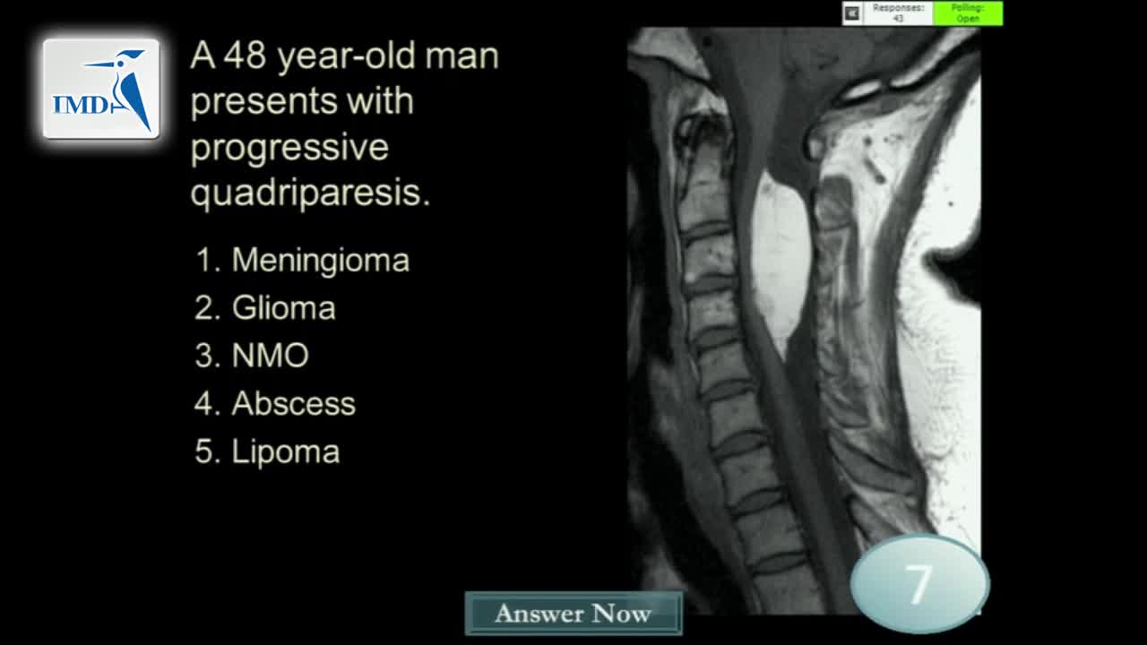 《神经科》2019年第3讲（总第158讲）基于病例学习神经影像学（3）