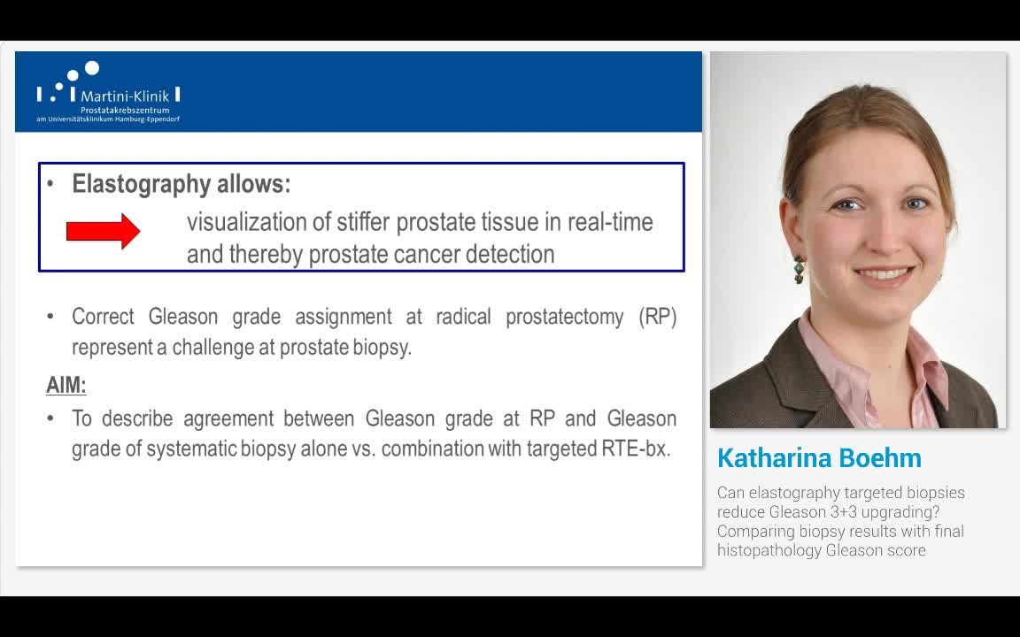 Can elastography targeted biopsies reduce Gleason 3+3 upg..-