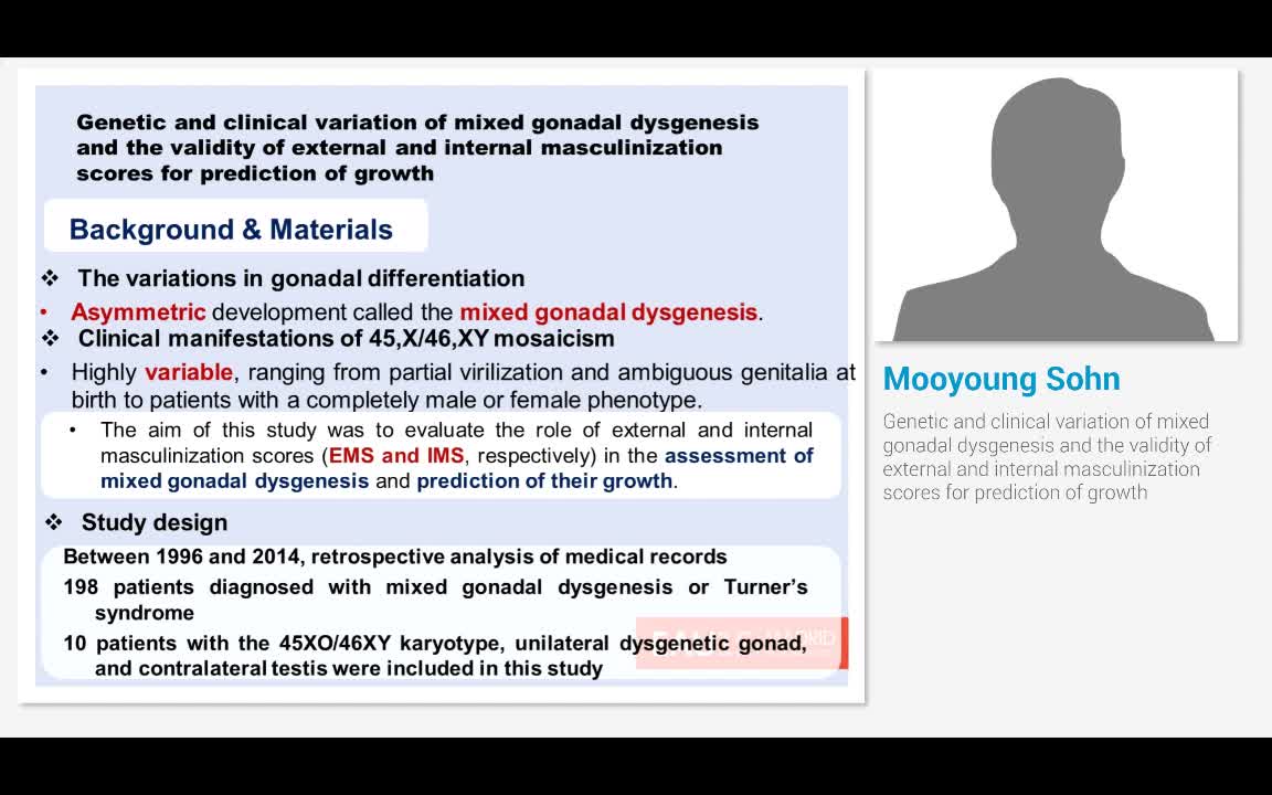 Genetic and clinical variation of mixed gonadal dysgenesi..-
