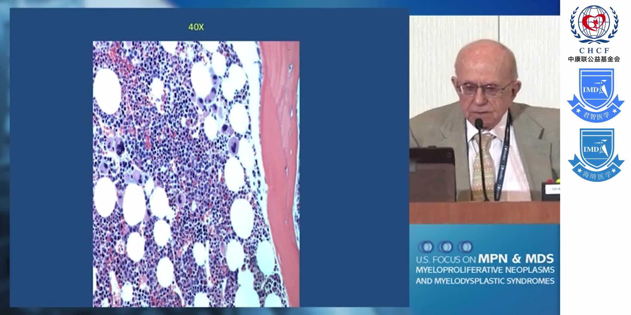 Update on Long-acting Interferons for MPN 1-7