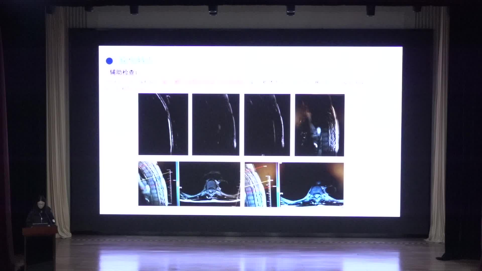 天坛医院讲课12月25号&mdash;硕士研究生病例讨论（3）