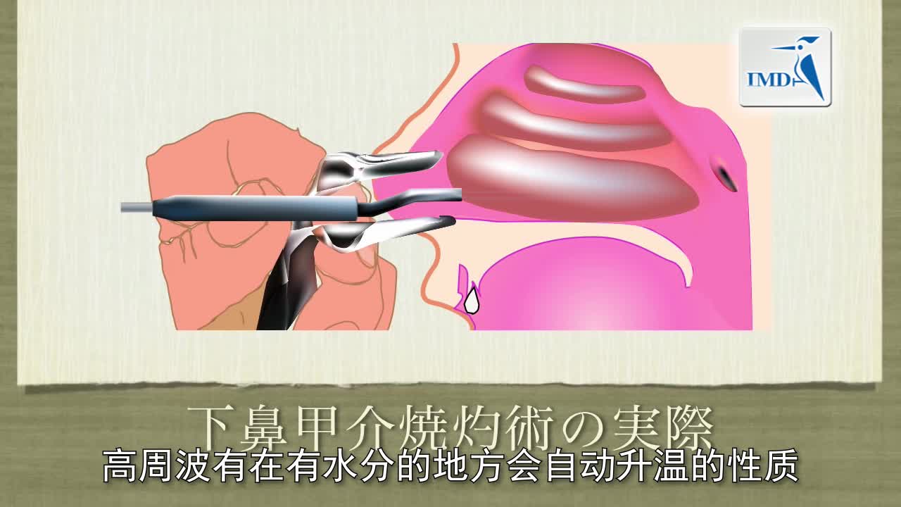 为什么会有鼻塞现象？（2）