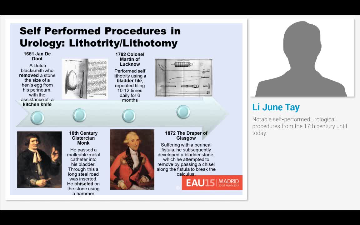 Notable self-performed urological procedures from the 17t..-