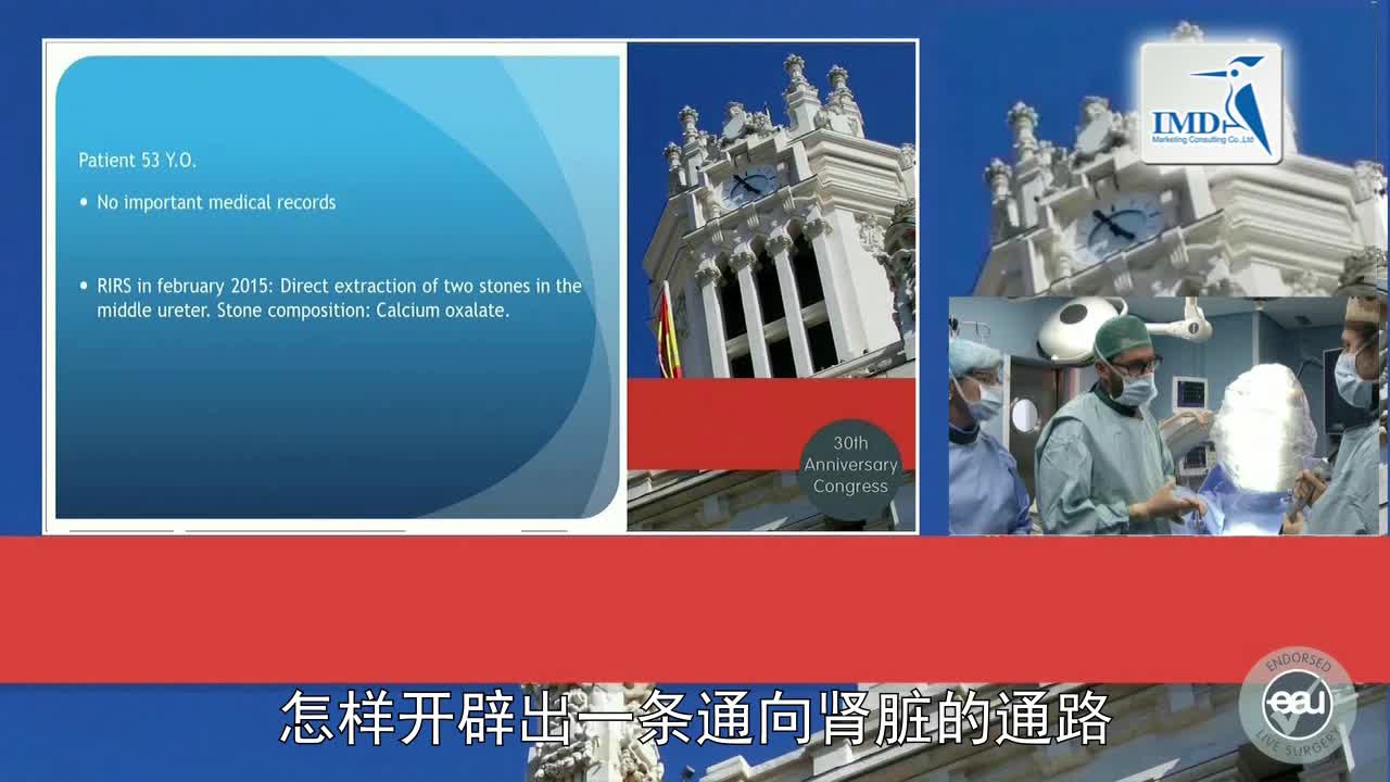 SPIES辅助逆向输尿管软镜诊断治疗上尿路结石（1）