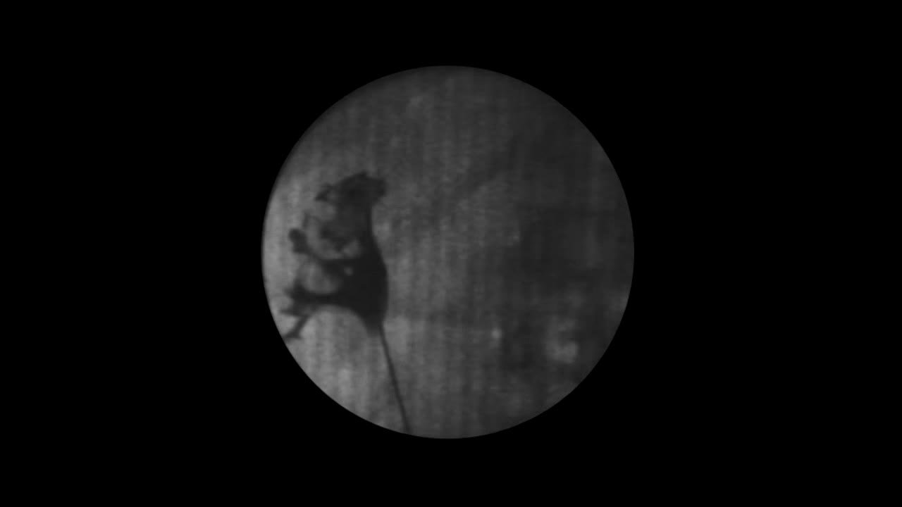 Large upper-calyx stone, Can supra-twelfth PCNL approach ..-