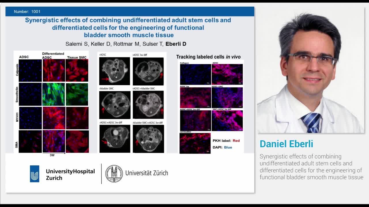 Synergistic effects of combining undifferentiated adult s..-