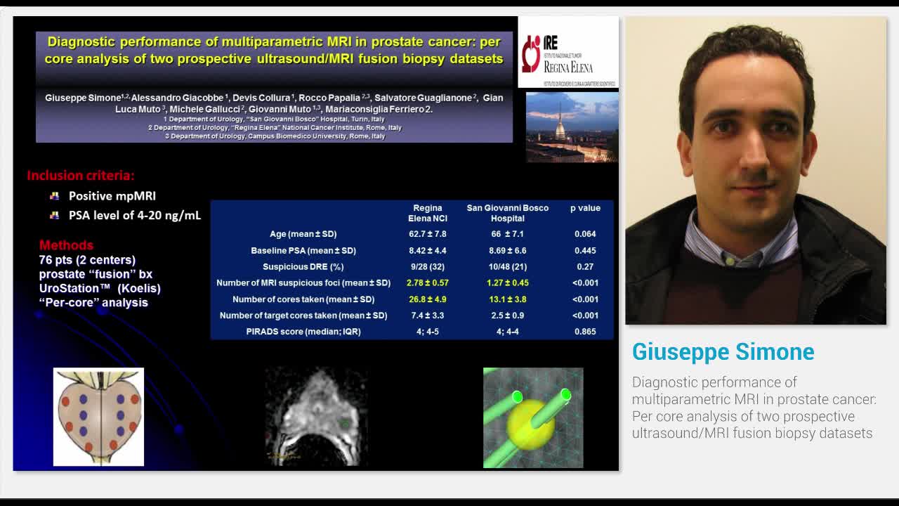 Diagnostic performance of multiparametric MRI in prostate..-
