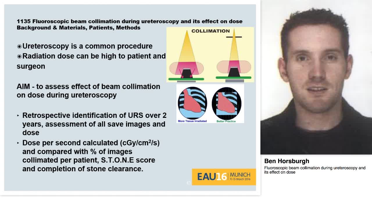 Fluoroscopic beam collimation during ureteroscopy and its-