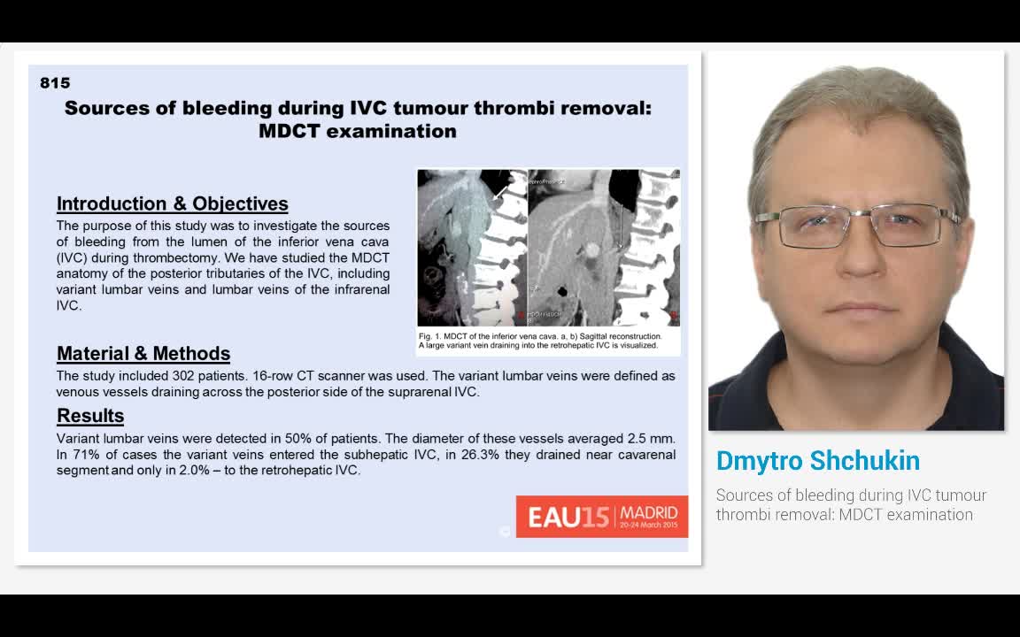 Sources of bleeding during IVC tumour thrombi removal, MD..-