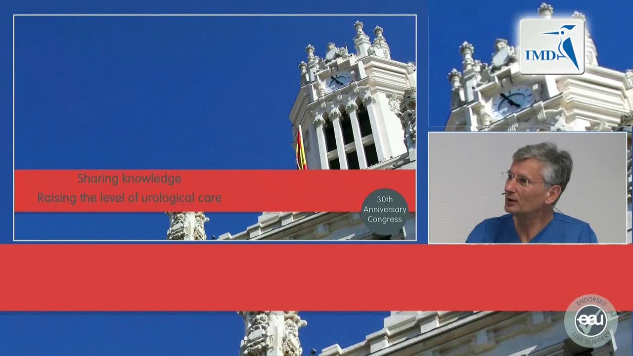 根治性前列腺切除单口手术（1）