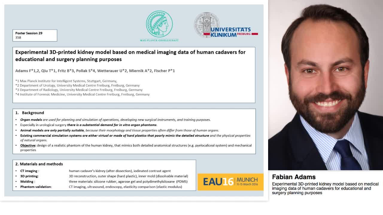 Experimental 3D-printed kidney model based on medical ima-