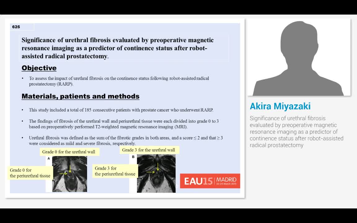 Significance of urethral fibrosis evaluated by preoperati..-