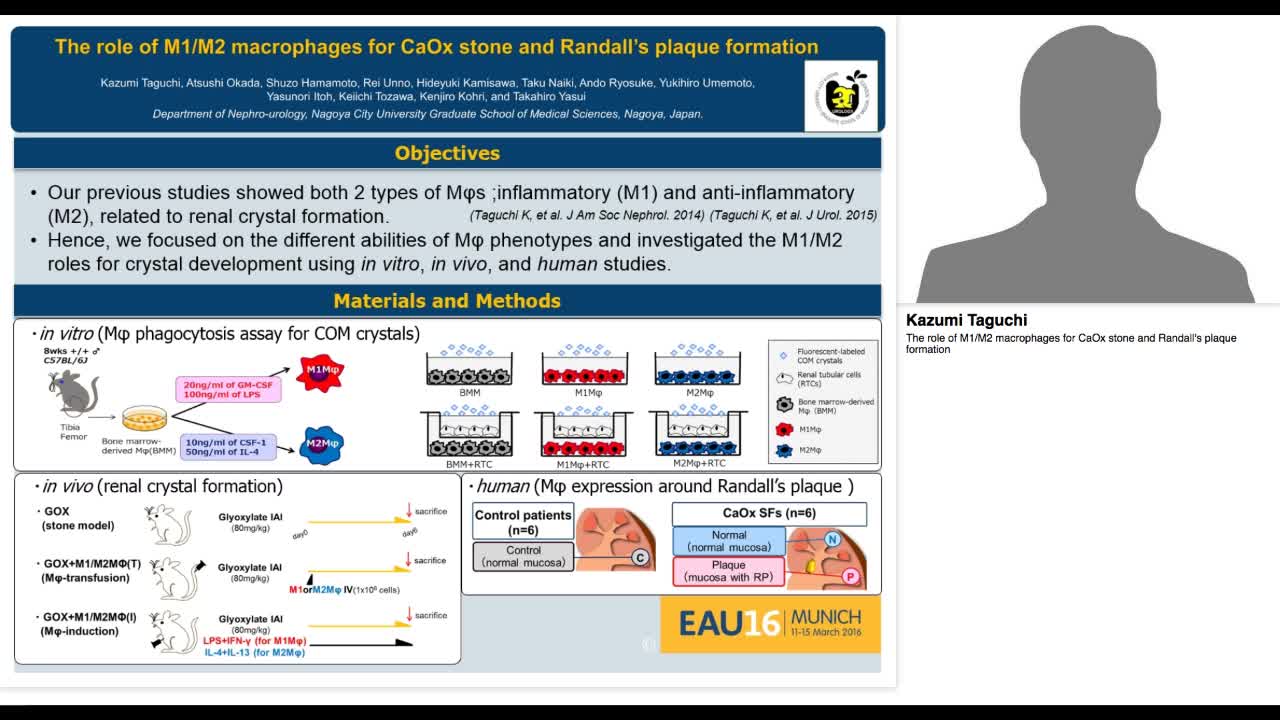 The role of M1-M2 macrophages for CaOx stone and Randall'-
