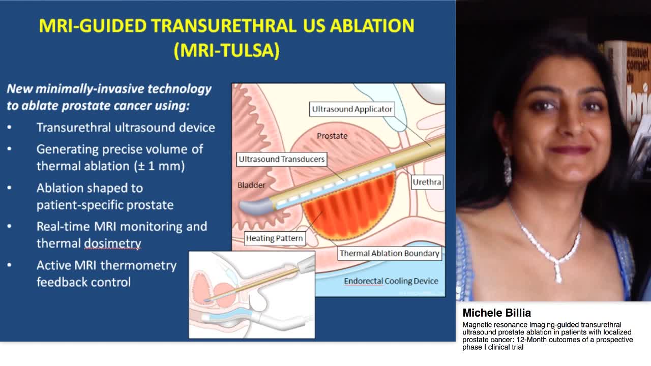 Magnetic resonance imaging-guided transurethral ultrasoun-