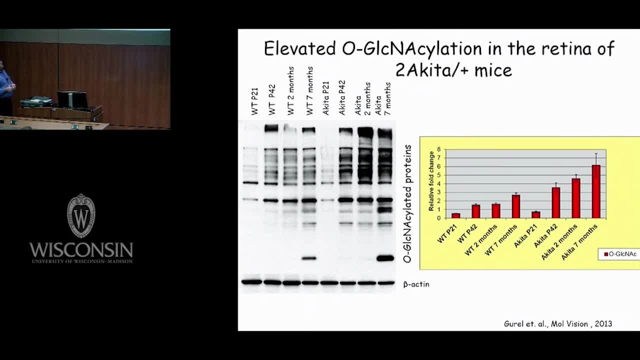 增生型糖尿病视网膜病变（11）