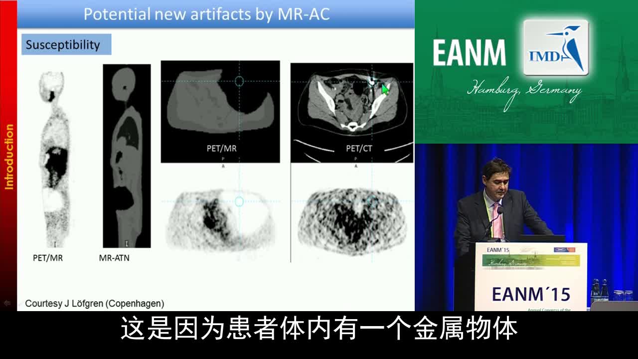 PET和MR在软组织肉瘤诊断治疗中的作用（3）