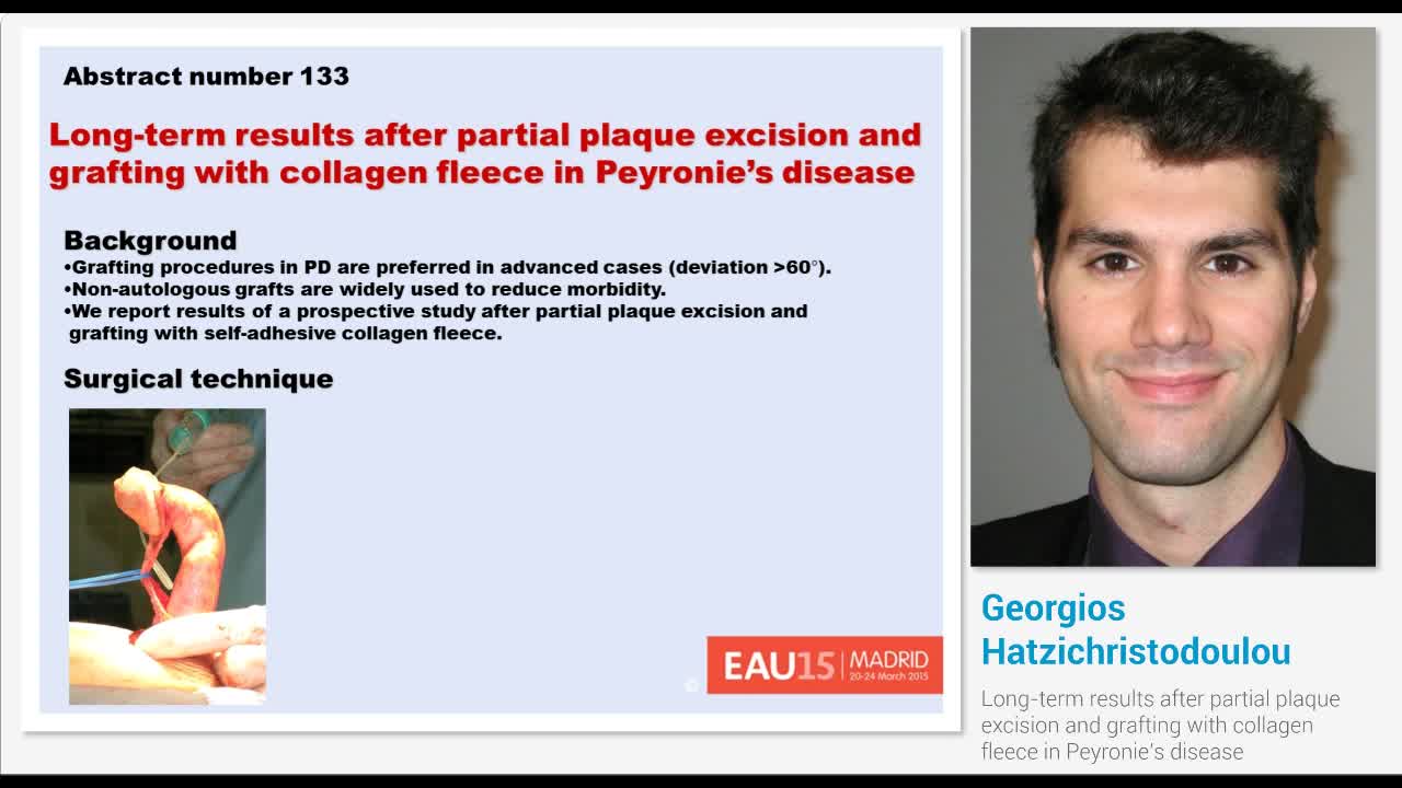 Long-term results after partial plaque excision and graft..-
