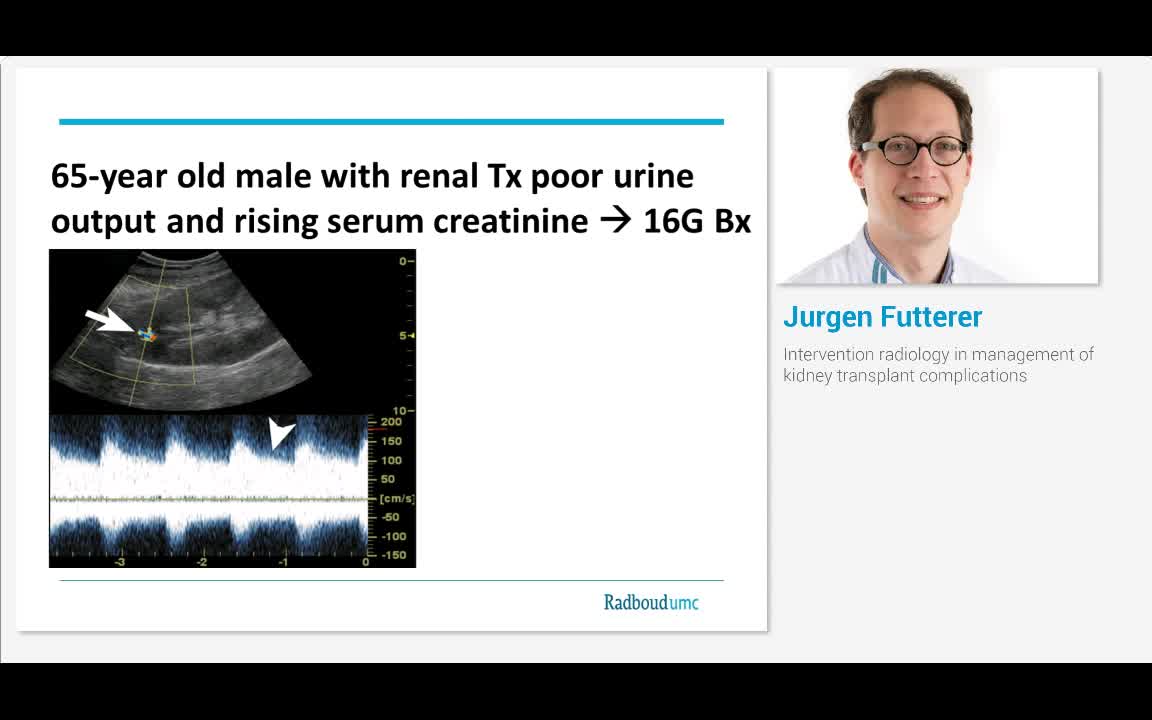 Intervention radiology in management of kidney transplant..-