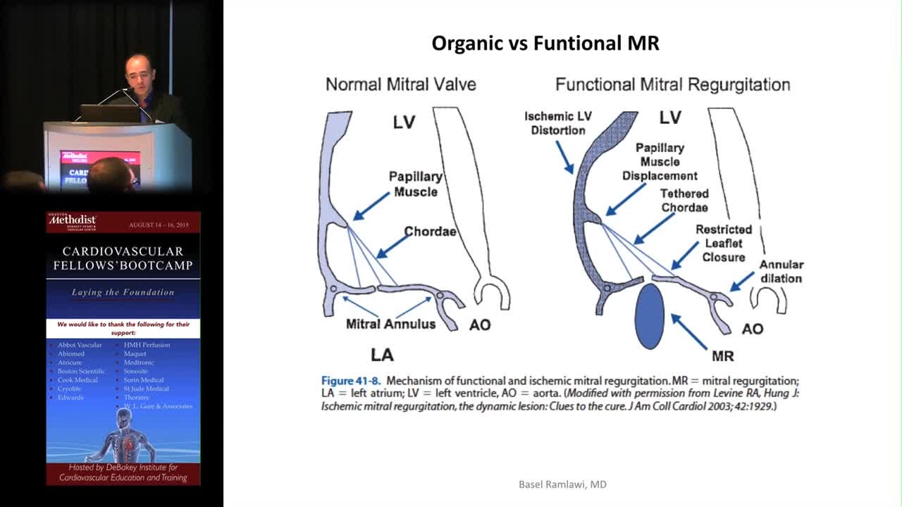 普外科医生教育课程-心瓣膜病手术 2