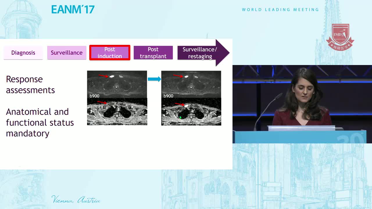 标准MRI的MM和透视4