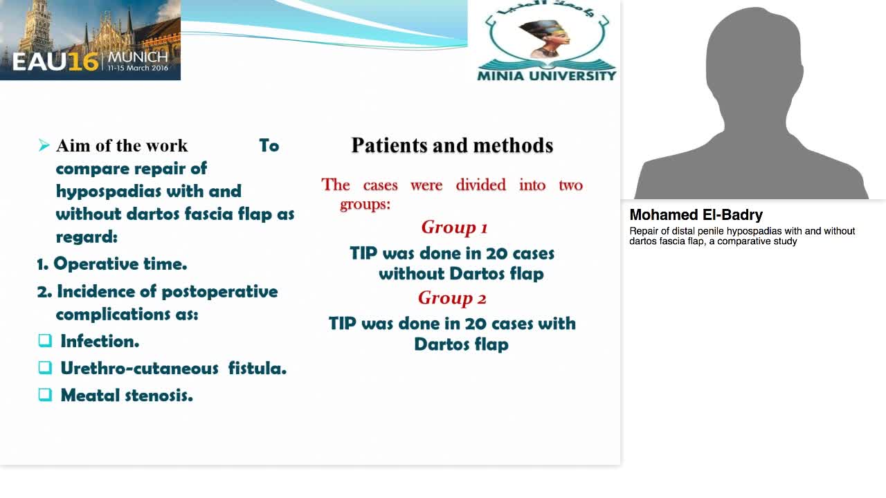 Repair of distal penile hypospadias with and without dart-