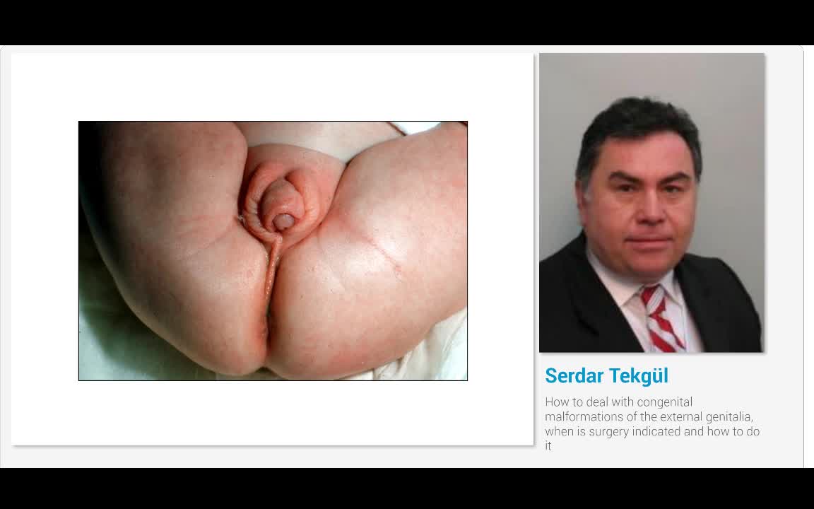 How to deal with congenital malformations of the external..-