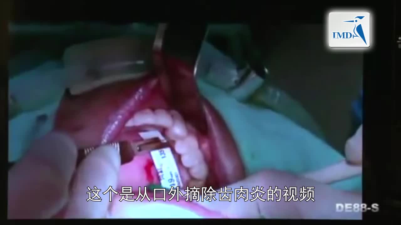 齿外科手术基本篇（1）