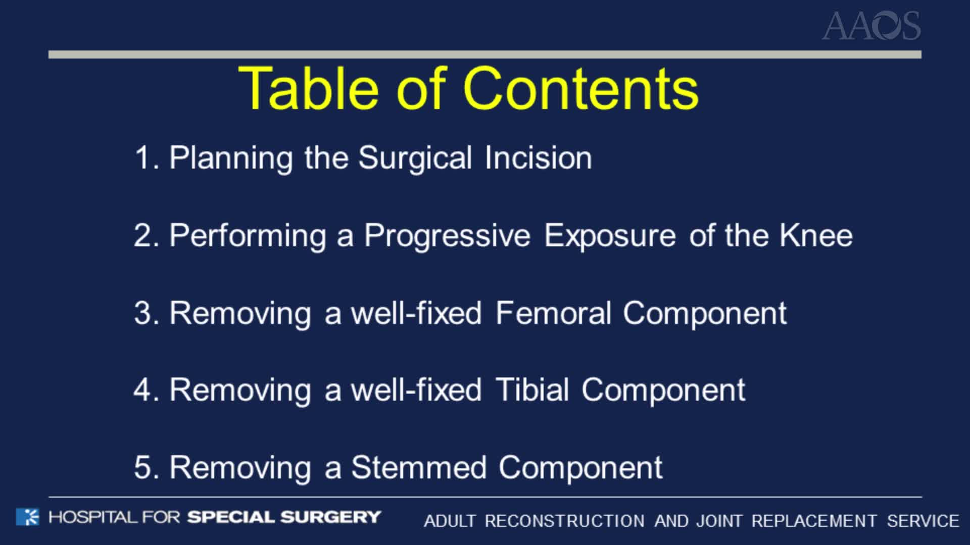 Revision Total Knee Arthroplasty Exposure & Component Removal