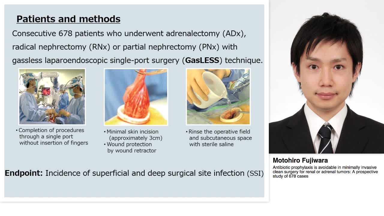 Antibiotic prophylaxis is avoidable in minimally invasive-