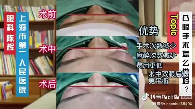 凸眼手术怎么做好