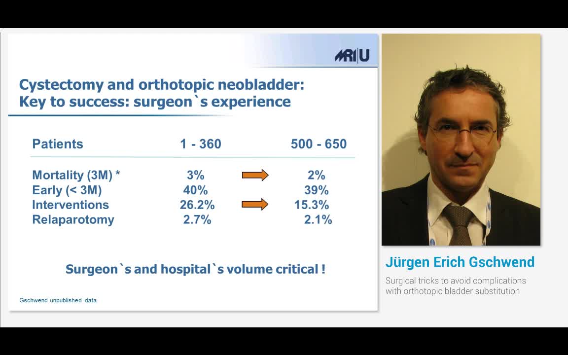 Surgical tricks to avoid complications with orthotopic bl..-