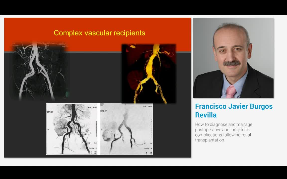 How to diagnose and manage postoperative and long-term co..-