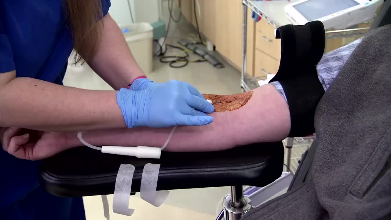 献血者受益于低剂量铁补充剂