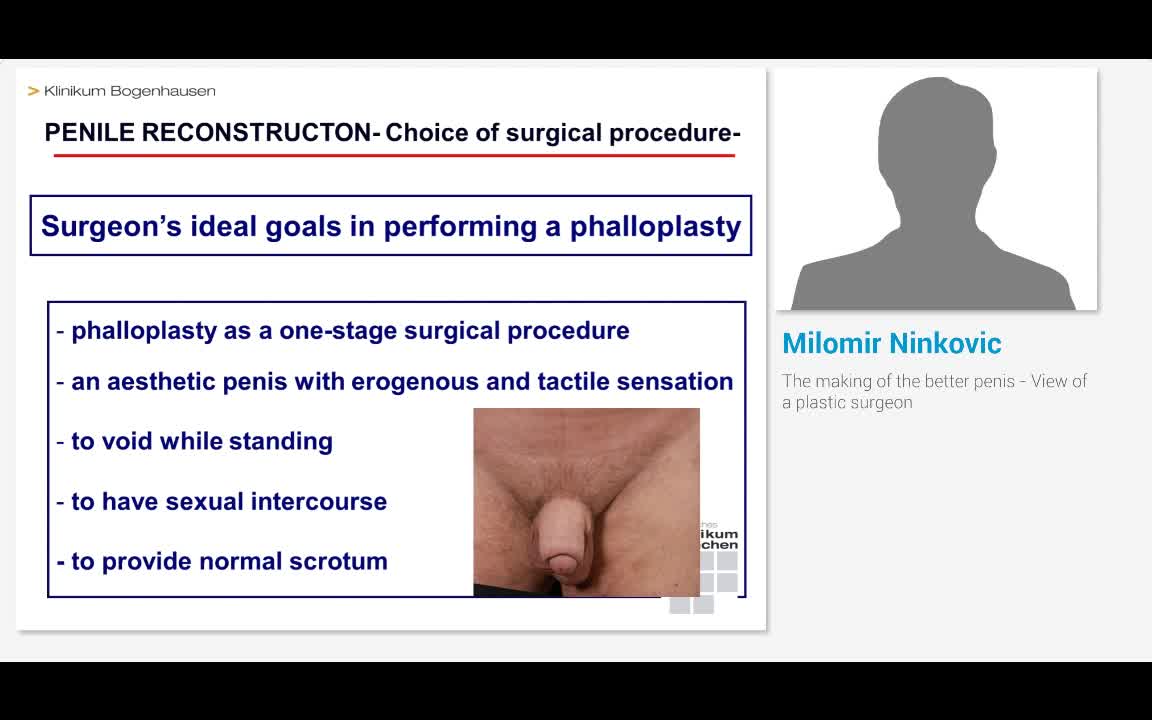 The making of the better penis - View of a plastic surgeon