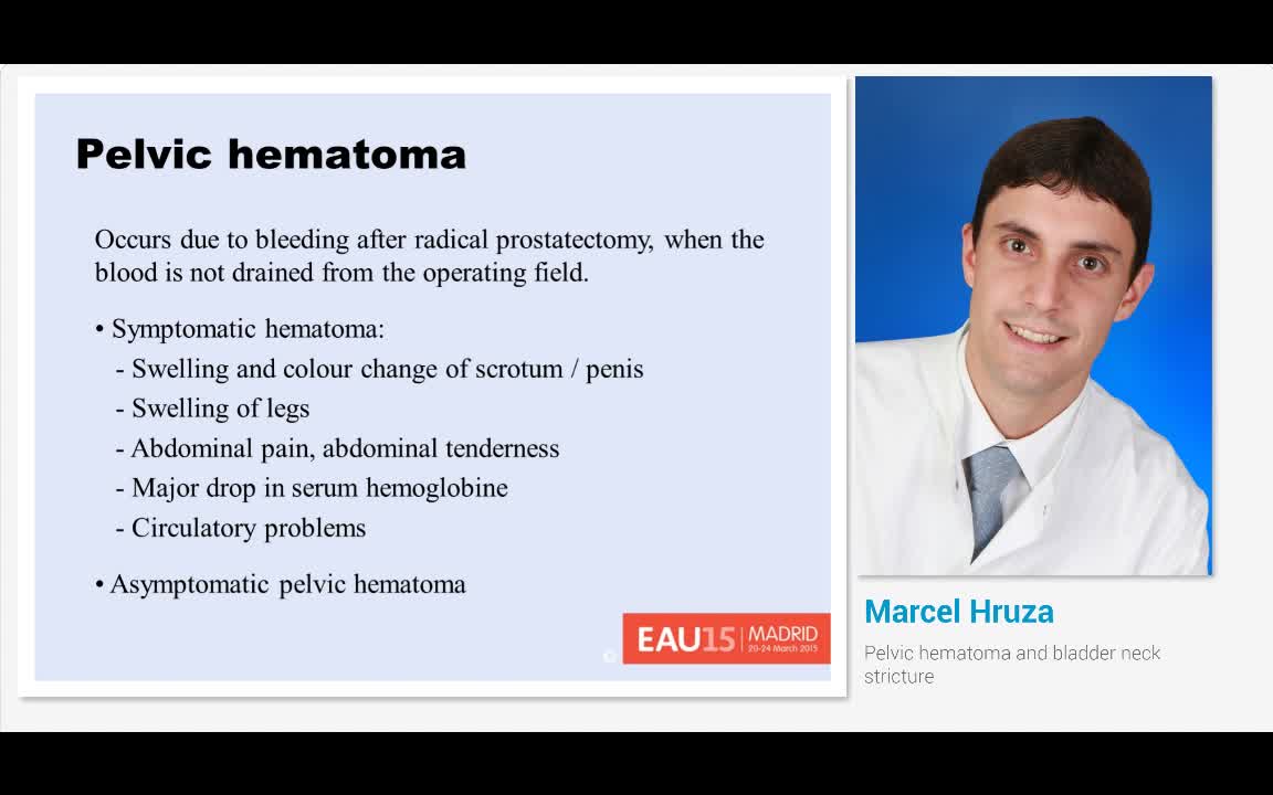 Pelvic hematoma and bladder neck stricture