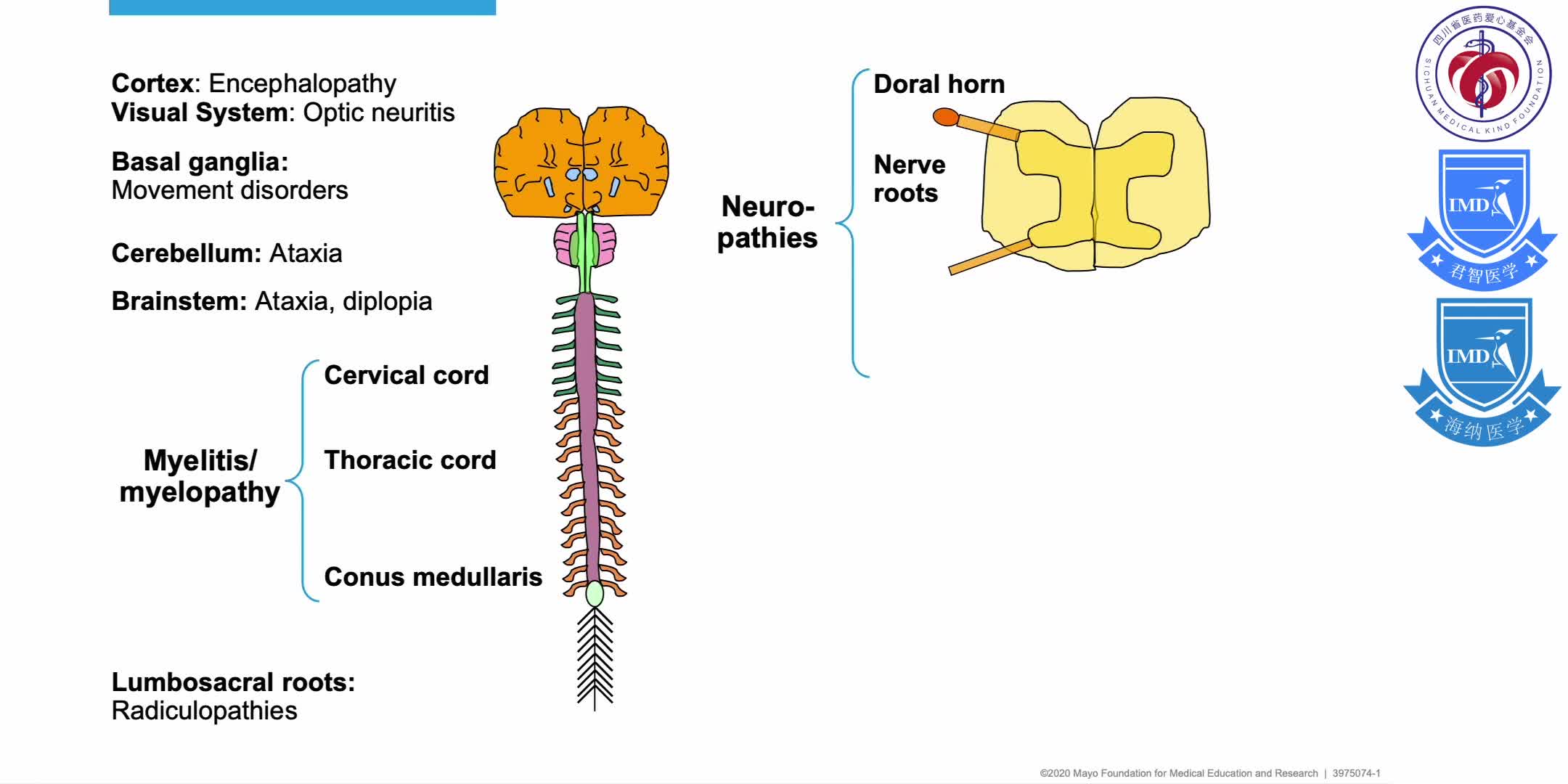 presents a summary of autoimmune central nervous system (CNS) disorders 2
