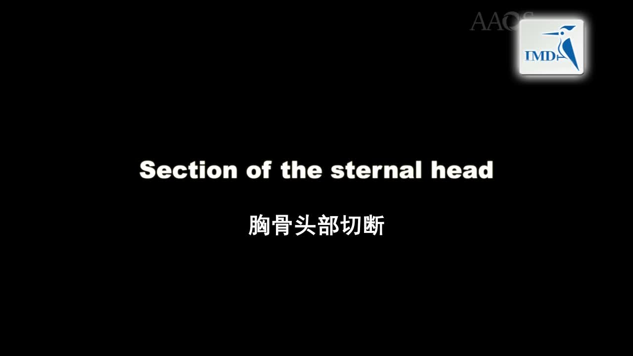 先天性肌性斜颈：微创双极腱切断术（2）