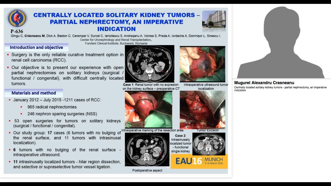 Centrally located solitary kidney tumors - partial nephre-