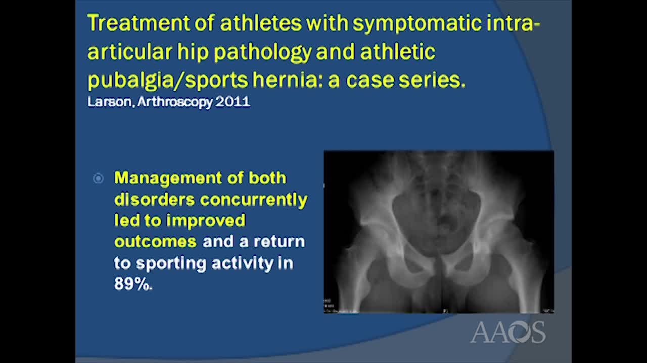 ENDOSCOPIC PUBICSYMPHYSECTOMY