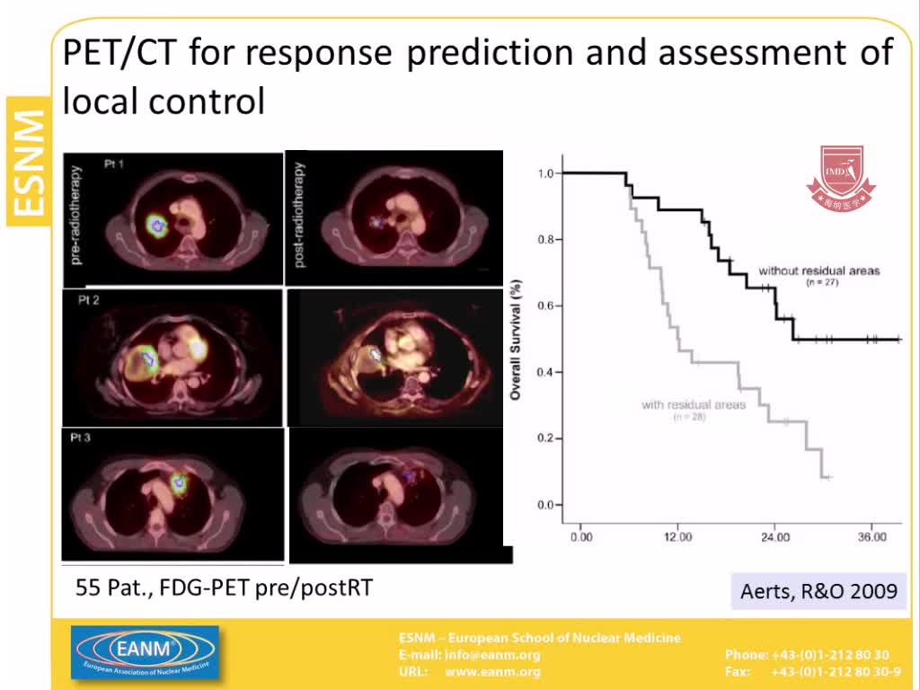 PET CT用于肺癌及其在放射治疗中的应用4