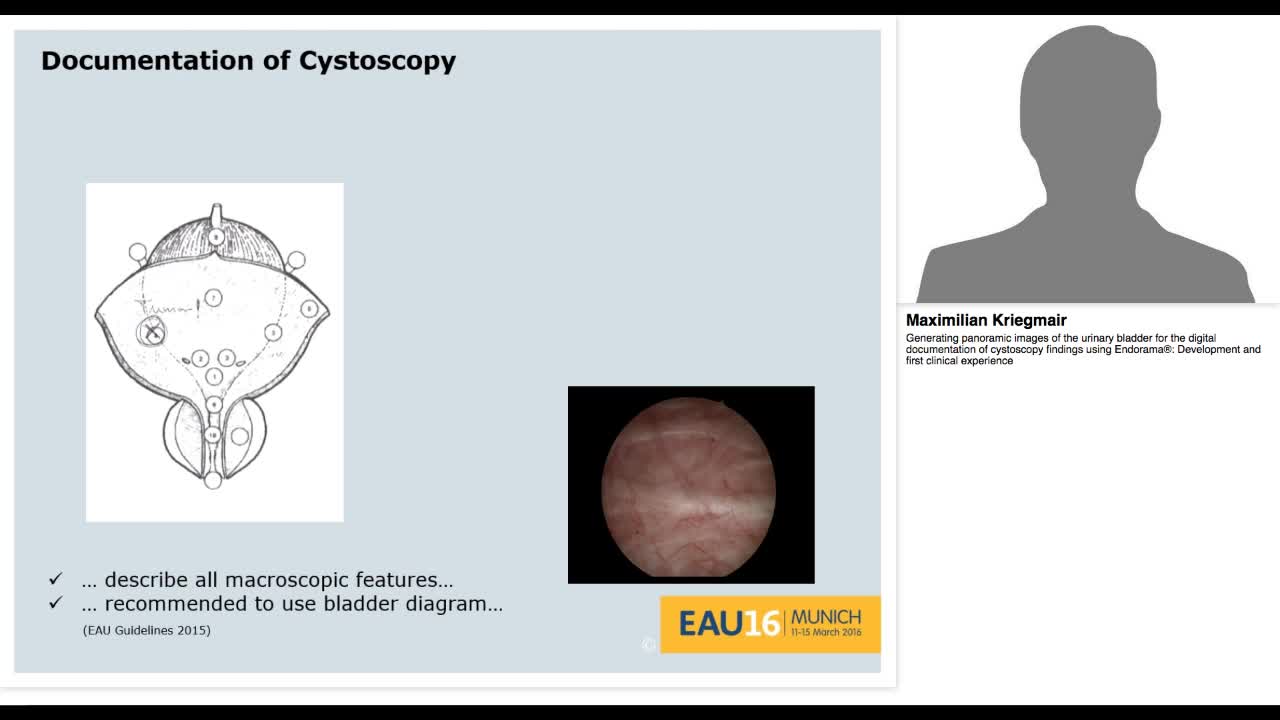 Generating panoramic images of the urinary bladder for th-